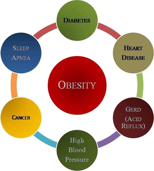 Obesity and Disease Prevention - Obesity, causes, complications and
prevention - Homeopathic Specialist‎ Dr Harsh Sharma