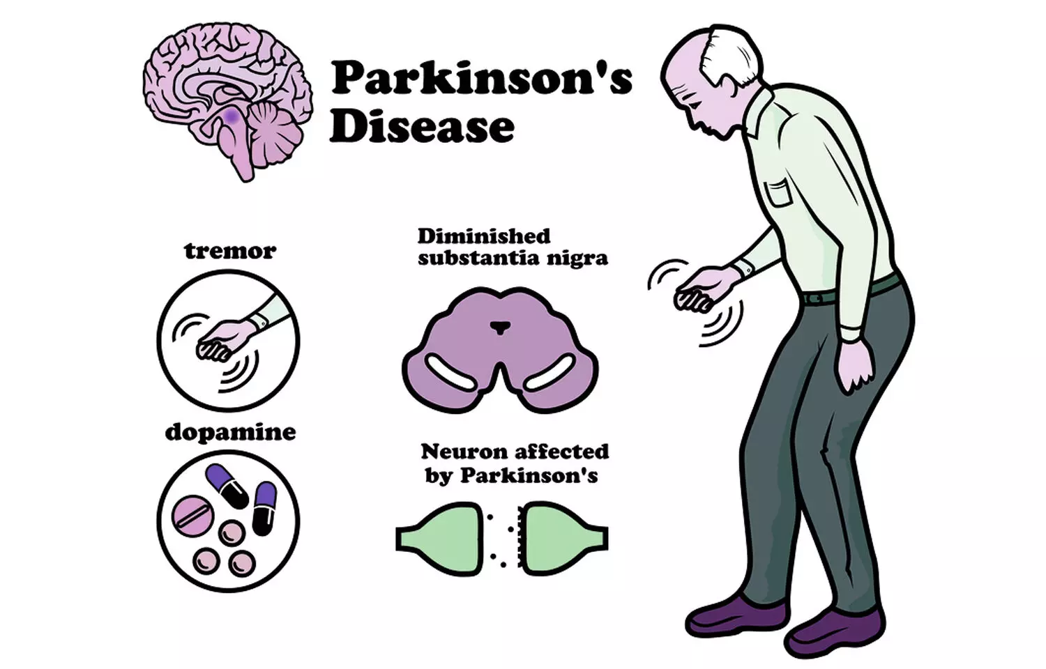 5 Best Homeopathic Medicines For Parkinsons Disease Homeopathic